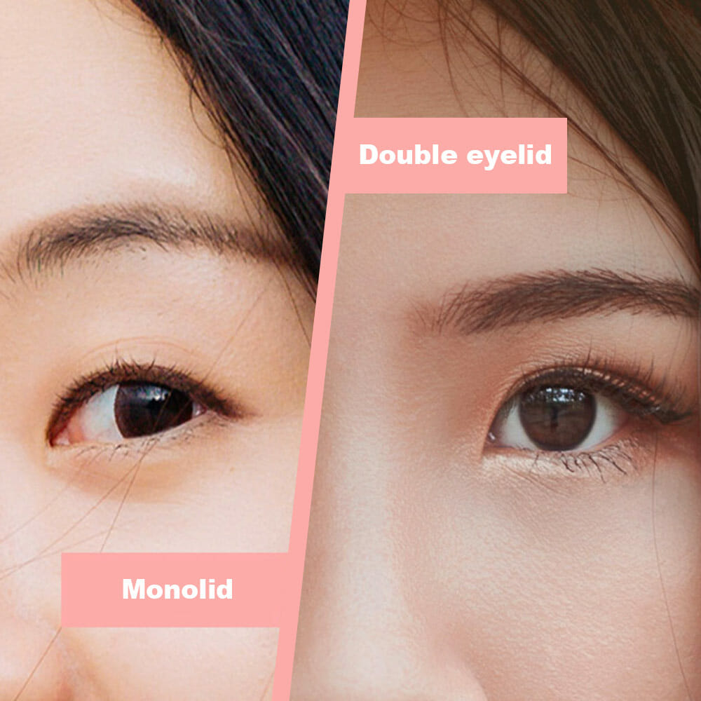 Monolids vs Double Eyelids