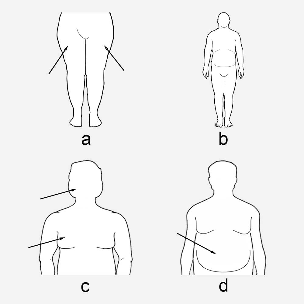 Gaining Weight Body Type